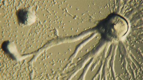  Dictyostelium discoideum: A Tiny Amoeba That Masters Cellular Teamwork Like No Other!