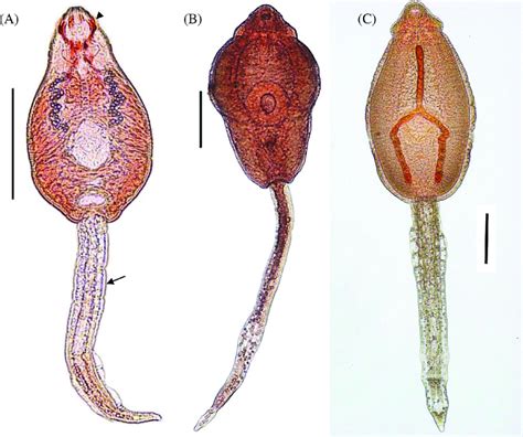  Echinostoma Revolutum: A Tiny Trematode That Can Pack a Punch!