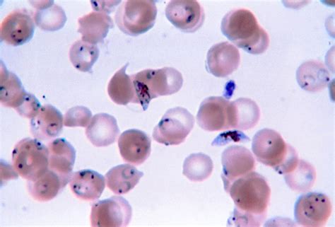  Plasmodium: A Microscopic Vampire That Can Suck Your Blood Dry!