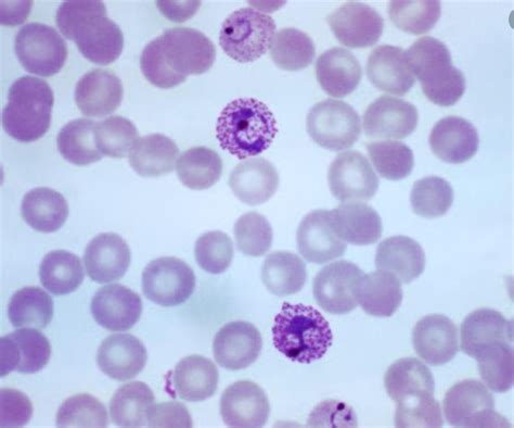  Plasmodium - Ký sinh trùng đơn bào có khả năng biến đổi hình dạng đáng kinh ngạc!